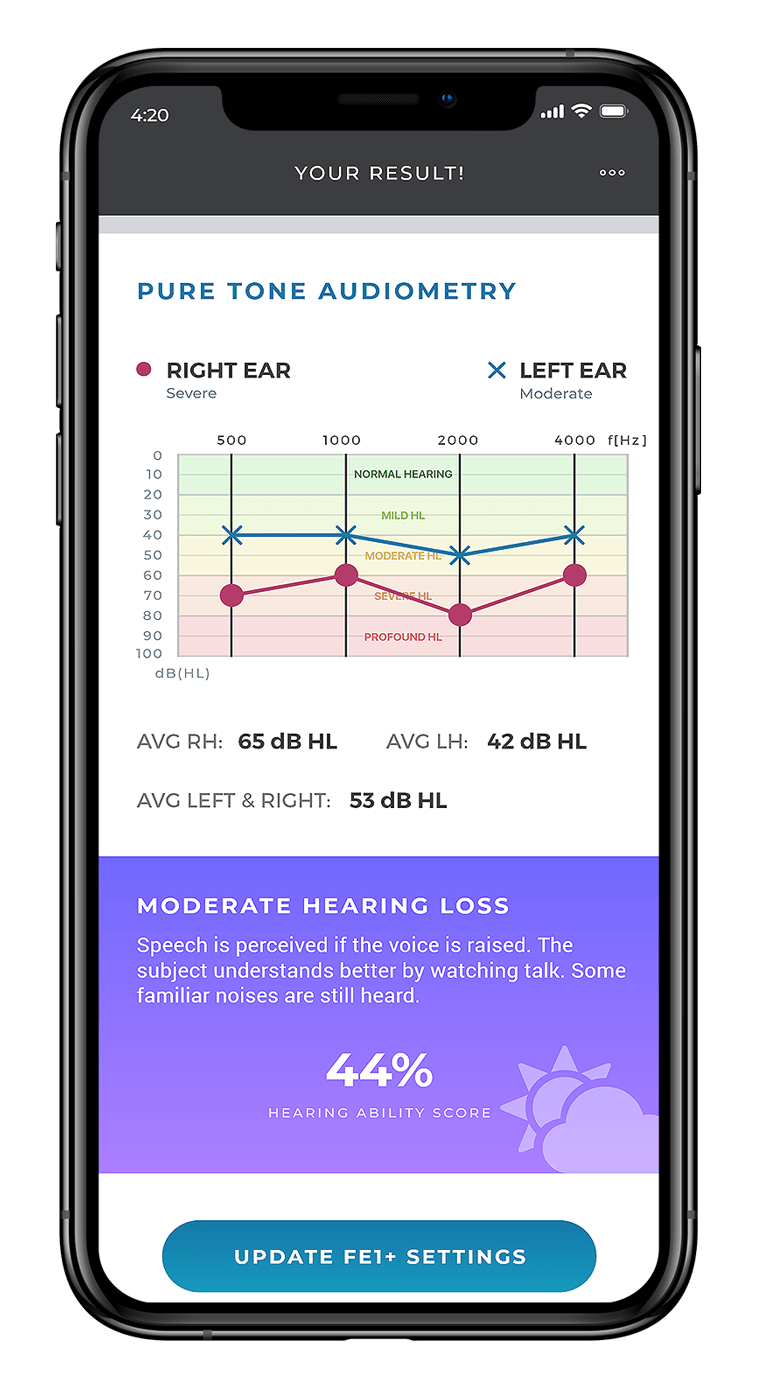 FrenchEar Application - Pure tone audiometry results